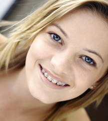 stock photo teen girl wearing clear braces